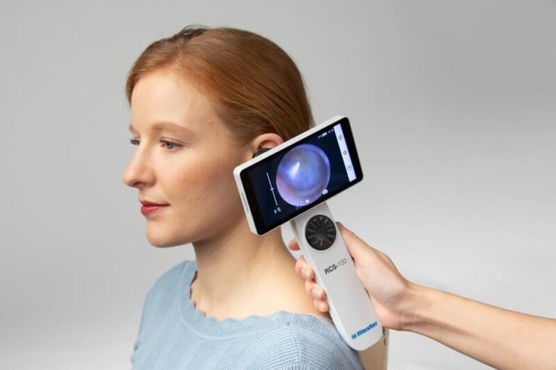 RCS-100 Digital Otoscope